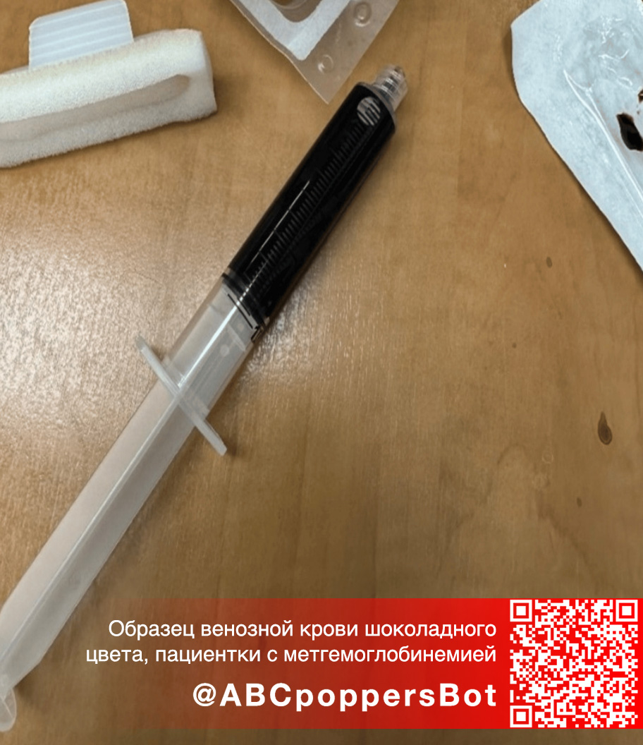 Если принять попперс внутрь в Вологде это вызывает метгемоглобинемию. Смертельное состояние Если принять попперс внутрь в Вологде это вызывает метгемоглобинемию. Смертельное состояние